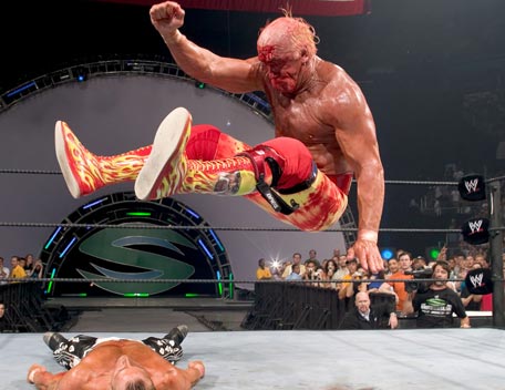 Study shows Hogan is only person ever injured by Hulk Hogan's leg
